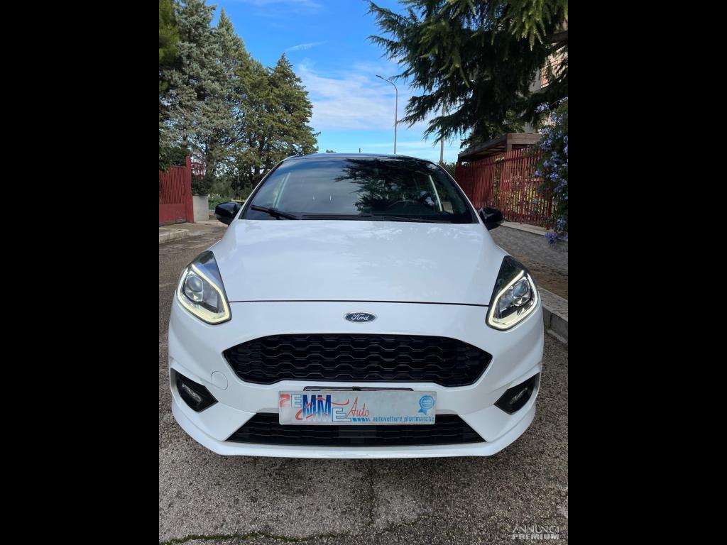 Ford Fiesta 1.5 TDCi 5 porte ST-Line - 2/20